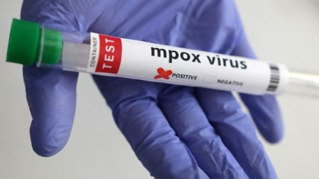 Qanada 34 məxməriçiçəyi yoluxması aşkarlanıbd