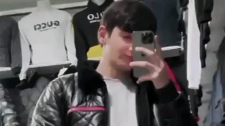 Faciə qurbanı olan Emilin görüntüsü