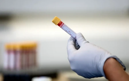 İşə qəbulda narkoloji rəy təqdim etməli olacağıq