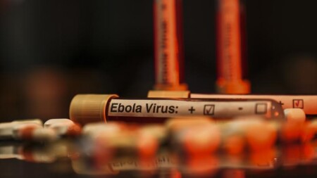 ÜST: Konqo Demokratik Respublikasında Ebola epidemiyasının ümumi riski çox yüksəkdir
